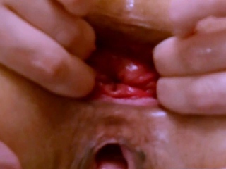 Anal MILF Gape – Hardcore Amateur Webcam Show